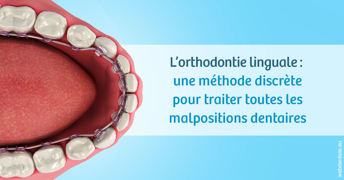 https://selarl-sandrine-dussert.chirurgiens-dentistes.fr/L'orthodontie linguale 1