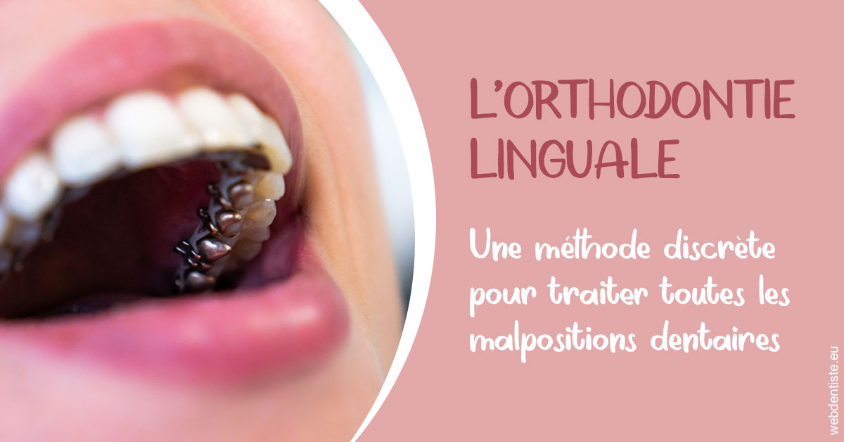 https://selarl-sandrine-dussert.chirurgiens-dentistes.fr/L'orthodontie linguale 2