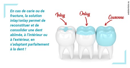 https://selarl-sandrine-dussert.chirurgiens-dentistes.fr/L'INLAY ou l'ONLAY