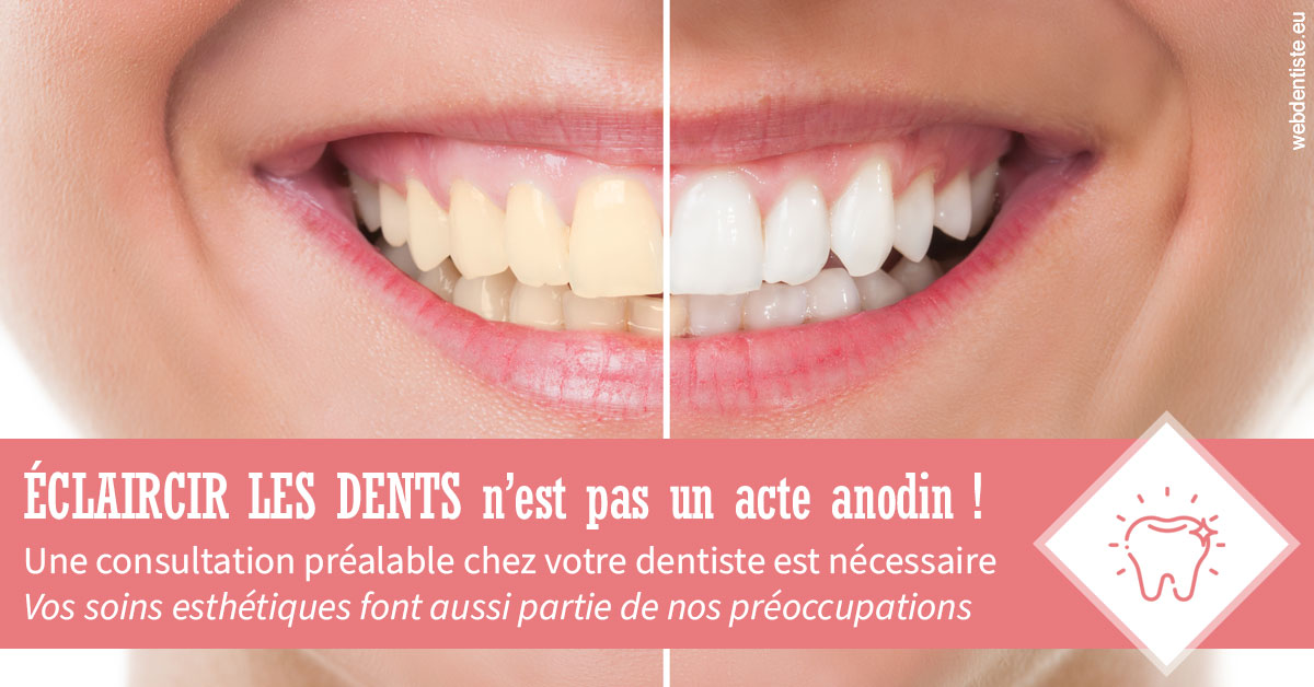 https://selarl-sandrine-dussert.chirurgiens-dentistes.fr/Eclaircir les dents 1