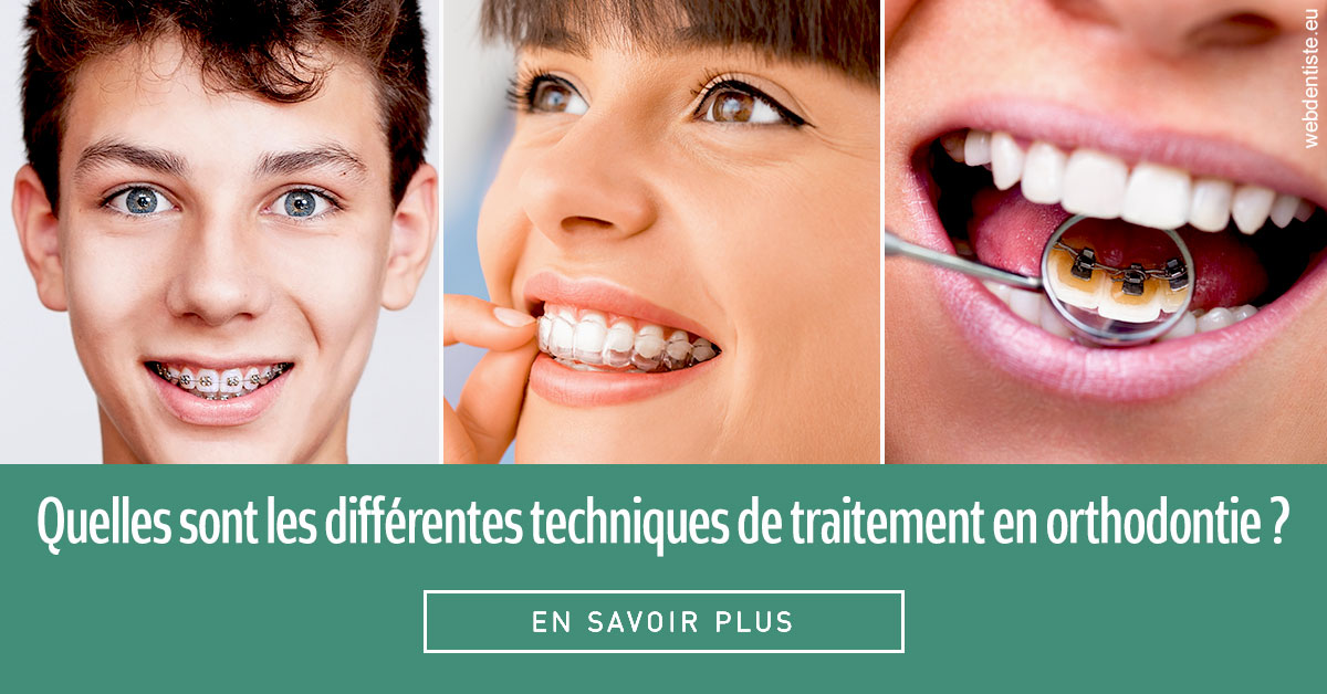 https://selarl-sandrine-dussert.chirurgiens-dentistes.fr/Les différentes techniques de traitement 2