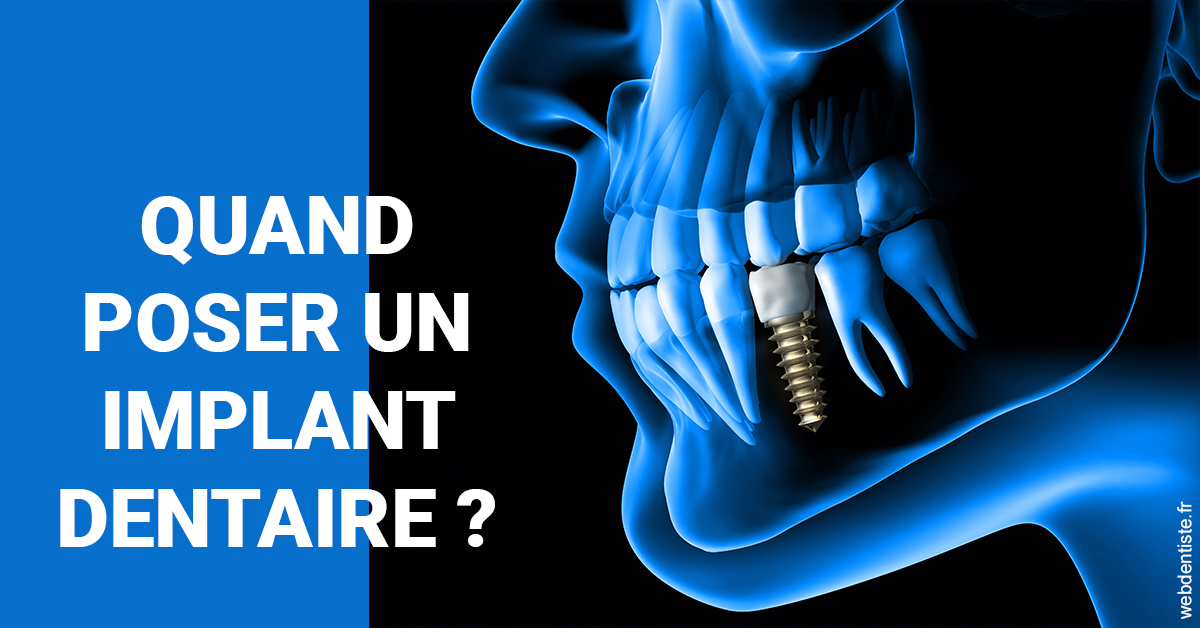 https://selarl-sandrine-dussert.chirurgiens-dentistes.fr/Les implants 1