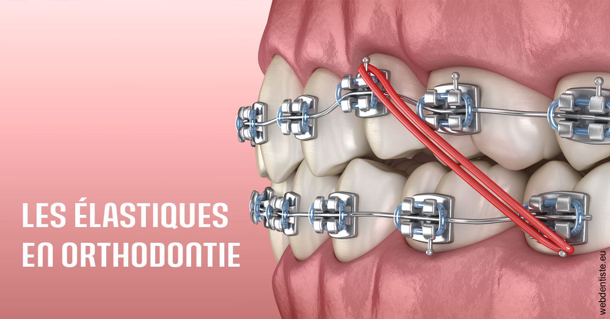 https://selarl-sandrine-dussert.chirurgiens-dentistes.fr/Elastiques orthodontie 2