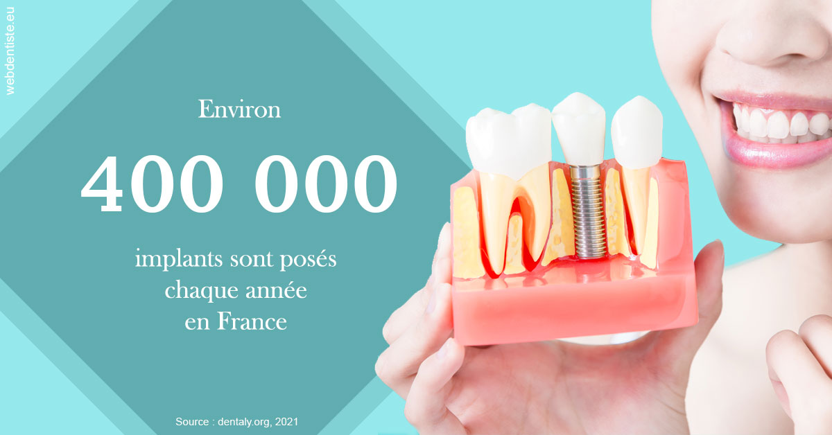 https://selarl-sandrine-dussert.chirurgiens-dentistes.fr/Pose d'implants en France 2