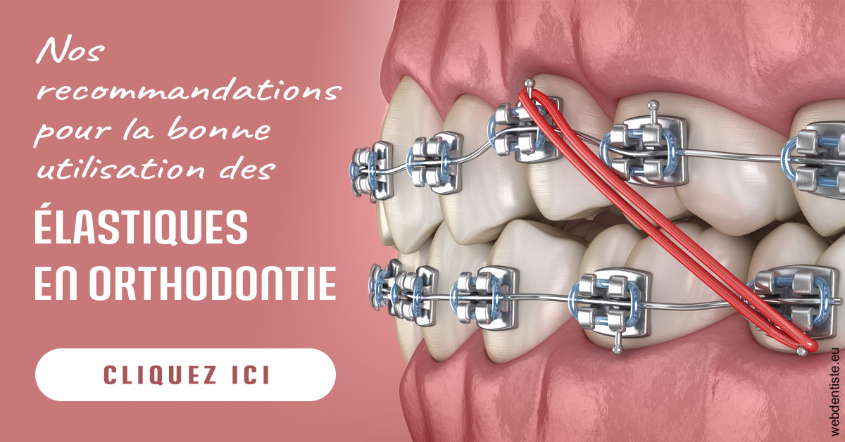 https://selarl-sandrine-dussert.chirurgiens-dentistes.fr/Elastiques orthodontie 2